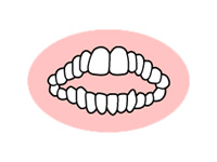 歯が噛み合わない（開咬）